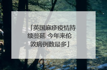 英国麻疹疫情持续蔓延 今年来伦敦病例数最多